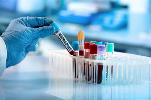 provette di sangue che vengono catalogate